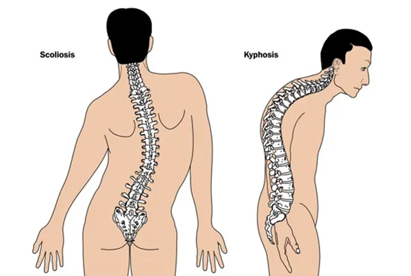 Chiropractic Body Alignment
